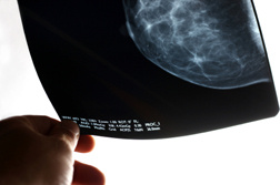 breast-cancer-mammography