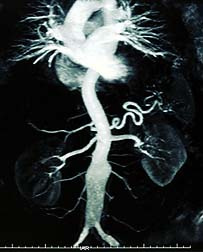 Kidney Diagnostic