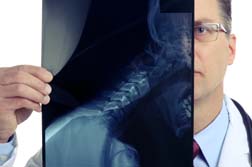 Make Sure an Experienced Attorney Settles Your Back and Neck Injury Lawsuit