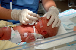 Paxil Birth Defects Trial Underway