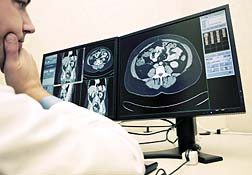 Radiologist Warns of MRI Health Risks, GE Sues for Libel