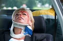 A Trio of Auto Accident Related Back and Neck Injuries