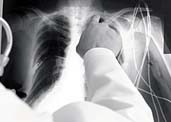 Asbestos Mesothelioma: Six Members of One Family Now Dead