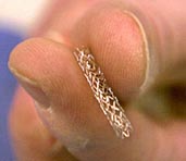 Feds Investigate Profits From Off-Label Heart Stent Procedures - Part I