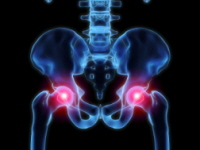 Johnson & Johnson Ordered to Pay $1 Billion in Hip Replacement Lawsuit