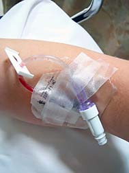 Unum Blood Transfusion