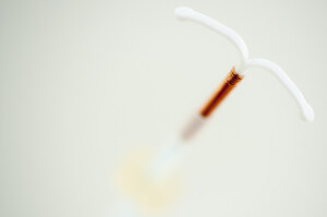 IUD Breakage an Increasing ParaGard Problem