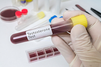 Testosterone Bellwether Trials Chosen