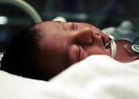 New study may verify Zoloft birth defects