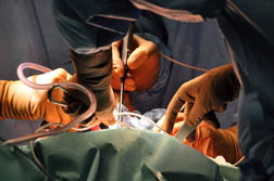 IVC Filters: There is no Standardization of Care