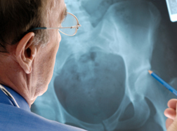 On the Trail of the Squeaky Hip Implant