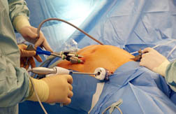 FDA Approves New Power Morcellation Device