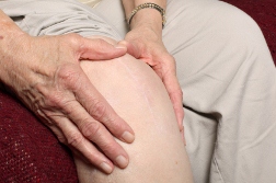 Zimmer NexGen Knee Replacement Linked to New Type of Failure