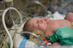 Wisconsin Plaintiffs Allege Newborn Daughter Succumbed to SSRI Birth Defects