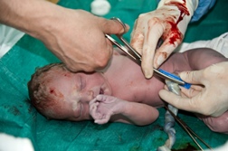 Did Effexor Birth Defects Cause Newborn's Death?