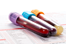 Alere Pushes for Dismissal of Home Blood Test Kits Class Action