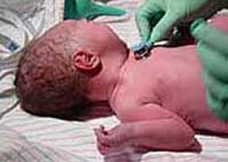 Studies Suggest Celexa Birth Defects Link, but Results Conflict