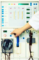 Study Shows Risk of NSF 77 Times Higher in Dialysis Patients