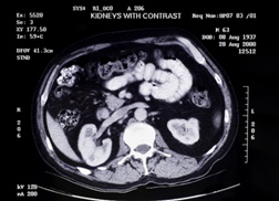 MRI Health Risks: FDA Increases Warnings