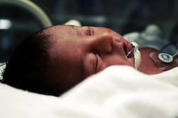 New study may verify Zoloft birth defects