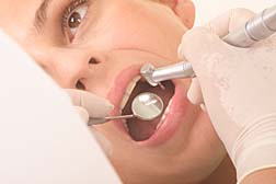 faulty Nobel dental implants